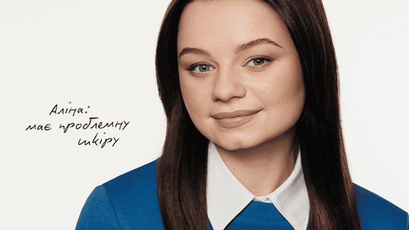 Аліна Зробила проблемну шкіру своєю силою, а її блог став підтримкою для інших.